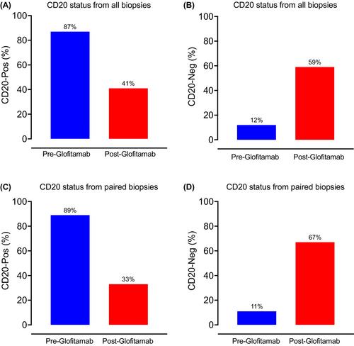 Relapse after glofitamab, a novel unmet medical need with high rates of CD20 loss