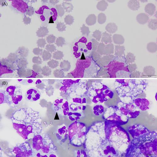 Detection of Anaplasma phagocytophilum in an inflammatory pericardial effusion of a dog