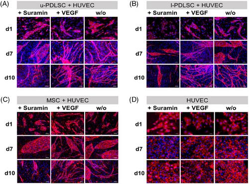 Angiogenic potential in periodontal stem cells from upper and lower jaw: A pilot study