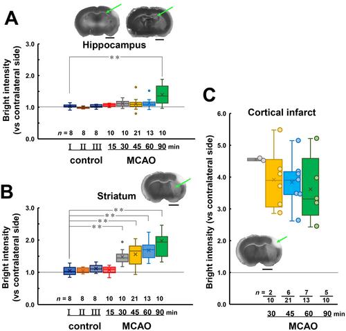 Striatal Blood Flow Changes by Middle Cerebral Artery Occlusion and Its Effect on Neurological Deficits in Mice