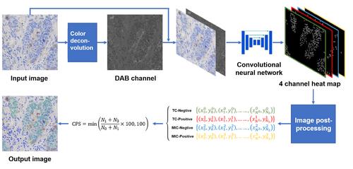 Artificial intelligence enhances whole-slide interpretation of PD-L1 CPS in triple-negative breast cancer: A multi-institutional ring study