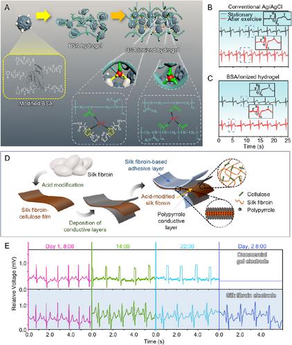 Recent Progress in the Development of Flexible Wearable Electrodes for Electrocardiogram Monitoring During Exercise