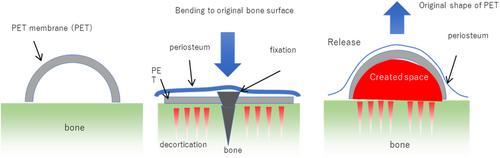 Static and dynamic guided bone regeneration using a shape-memory polyethylene terephthalate membrane: An experimental study in rabbit mandible