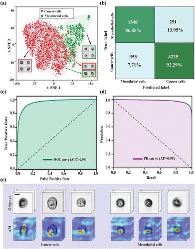 Diagnosis of Serous Effusion with Intelligent Imaging Flow Cytometry