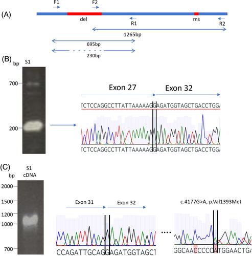 Biallelic FANCA variants detected in sisters with isolated premature ovarian insufficiency