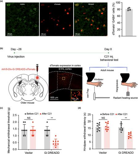 Aging-associated decrease of PGC-1α promotes pain chronification