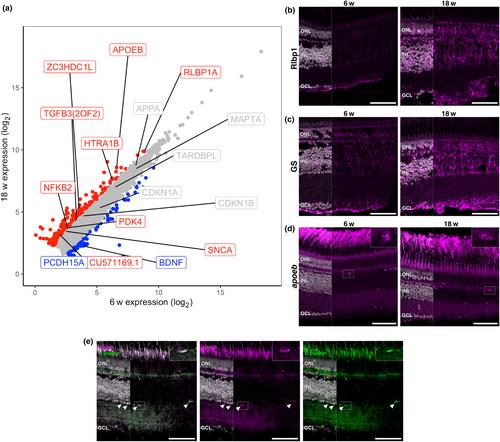 Age-related dysregulation of the retinal transcriptome in African turquoise killifish