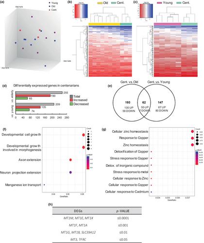 Centenarian hippocampus displays high levels of astrocytic metallothioneins