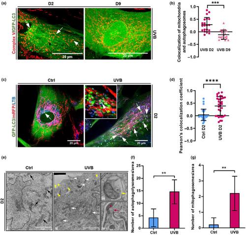 Elimination of damaged mitochondria during UVB-induced senescence is orchestrated by NIX-dependent mitophagy