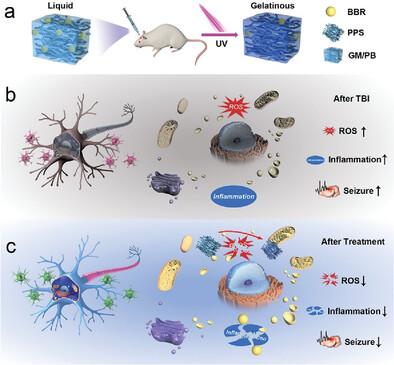 Microenvironment-Responsive Hydrogel Reduces Seizures After Traumatic Brain Injury in Juvenile Rats by Reducing Oxidative Stress and Hippocampal Inflammation