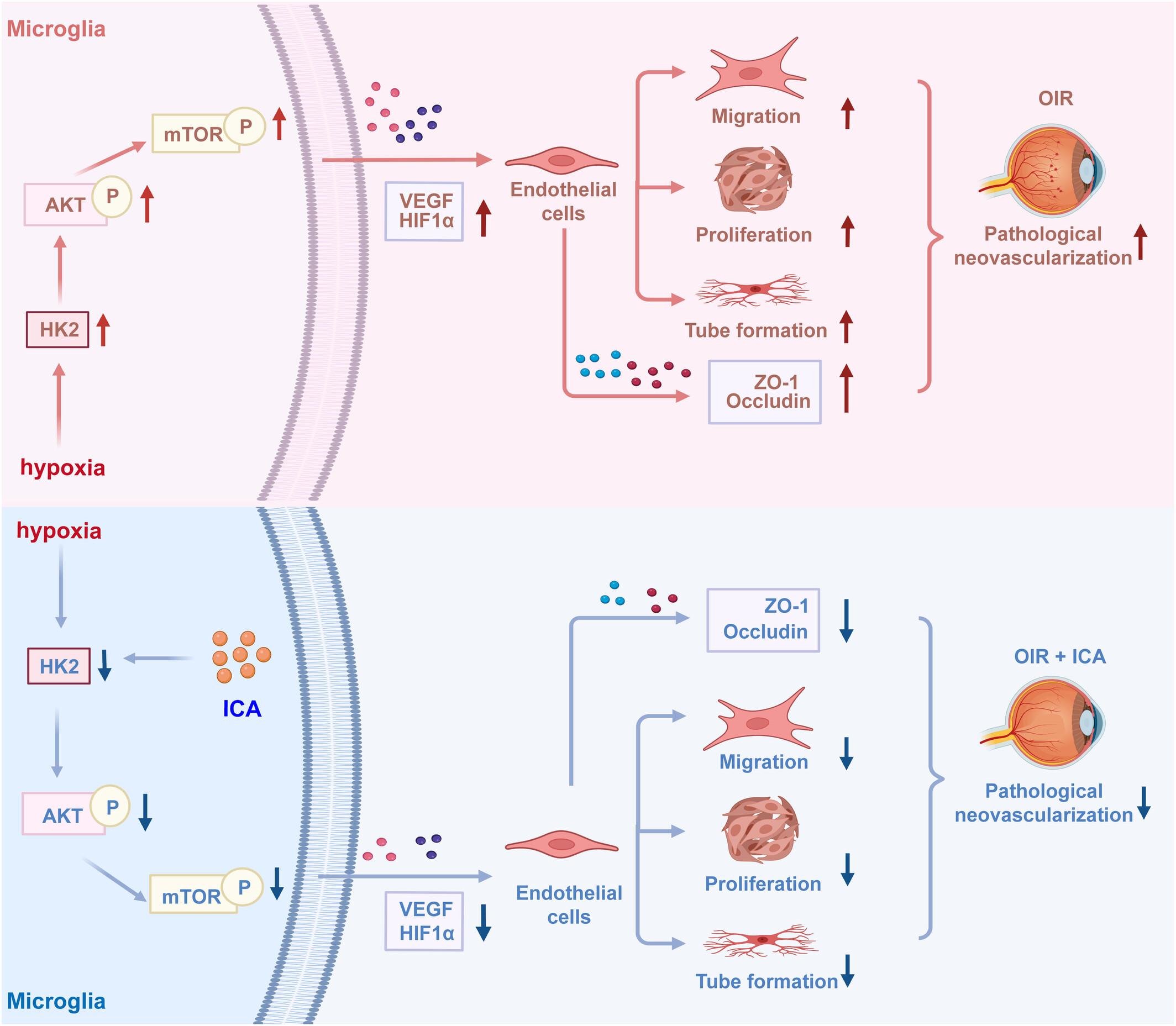 Icariin alleviates oxygen-induced retinopathy by targeting microglia hexokinase 2