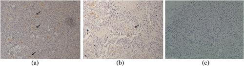 Correction to “Soluble production and function of vascular endothelial growth factor/basic fibroblast growth factor complex peptide”