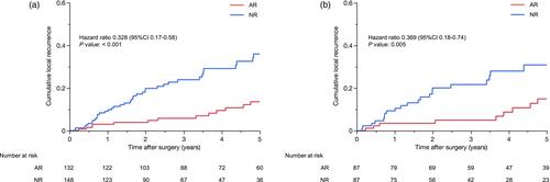 Impact of anatomical liver resection for hepatocellular carcinoma in preventing early-phase local recurrence after surgery