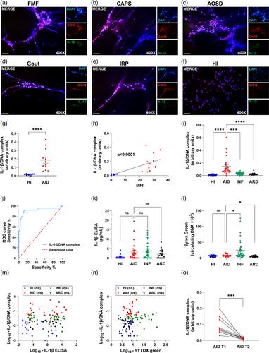 IL-1β/DNA complex elevation distinguishes autoinflammatory disorders from autoimmune and infectious diseases