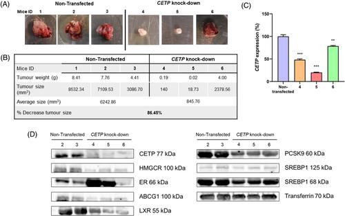 Cholesteryl ester transfer protein knock-down in conjunction with a cholesterol-depleting agent decreases tamoxifen resistance in breast cancer cells