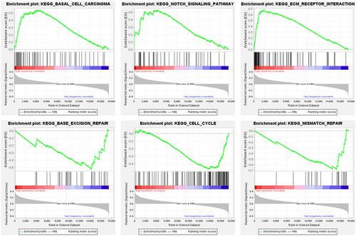 A new TGF-β risk score predicts clinical and immune landscape in colorectal cancer patients