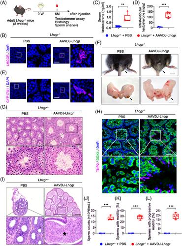 AAV-mediated gene therapy restores natural fertility and improves physical function in the Lhcgr-deficient mouse model of Leydig cell failure