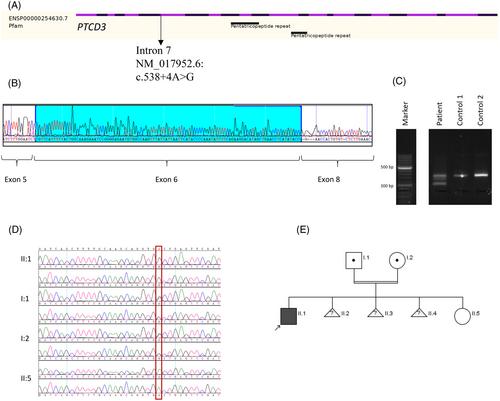 The phenotypic spectrum of PTCD3 deficiency