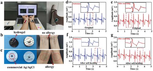 Smart Hydrogel Sensors for Health Monitoring and Early Warning