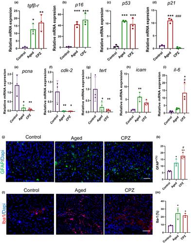 Long-term demyelination and aging-associated changes in mice corpus callosum; evidence for the role of accelerated aging in remyelination failure in a mouse model of multiple sclerosis