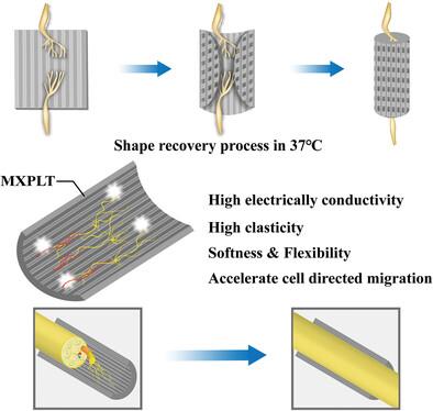 4D-Printed MXene-Based Artificial Nerve Guidance Conduit for Enhanced Regeneration of Peripheral Nerve Injuries