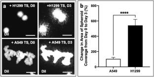 A Novel Ex Vivo Tumor Spheroid-Tissue Model for Investigating Microvascular Remodeling and Lymphatic Blood Vessel Plasticity