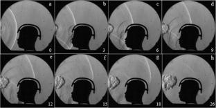 Investigation into helmet–head shock wave interactions at low overpressures through free-field blasts and schlieren imagery