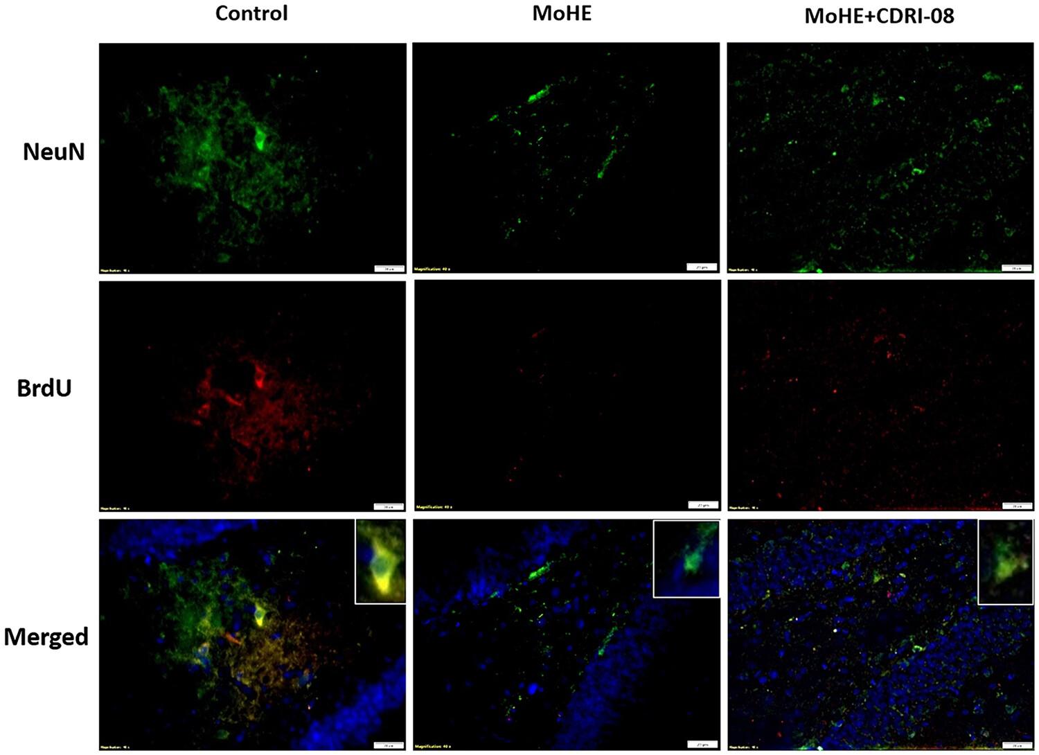 Restoration of hippocampal adult neurogenesis by CDRI-08 (Bacopa monnieri extract) relates with the recovery of BDNF–TrkB levels in male rats with moderate grade hepatic encephalopathy