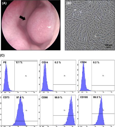 Tissue specific stem cell therapy for airway regeneration