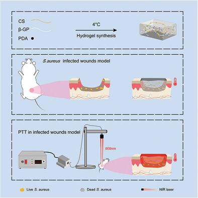 Injectable Photothermal PDA/Chitosan/β-Glycerophosphate Thermosensitive Hydrogels for Antibacterial and Wound Healing Promotion