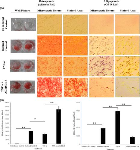 Stem cell secretome restore the adipo-osteo differentiation imbalance in diabetic dental pulp-derived mesenchymal stem cells