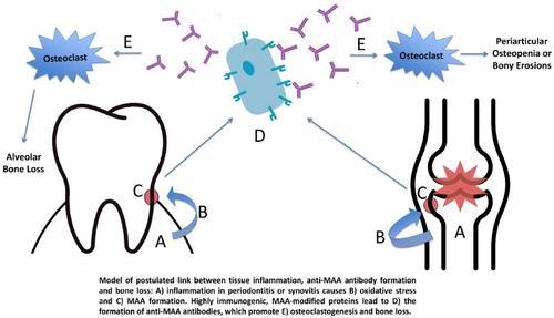 Associations between periodontitis and serum anti-malondialdehyde–acetaldehyde antibody concentrations in rheumatoid arthritis: A case-control study