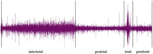 Deep learning-based seizure prediction using EEG signals: A comparative analysis of classification methods on the CHB-MIT dataset