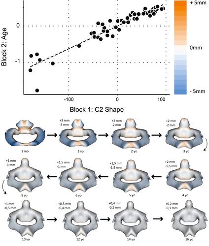 Geometric growth of the normal human craniocervical junction from 0 to 18 years old