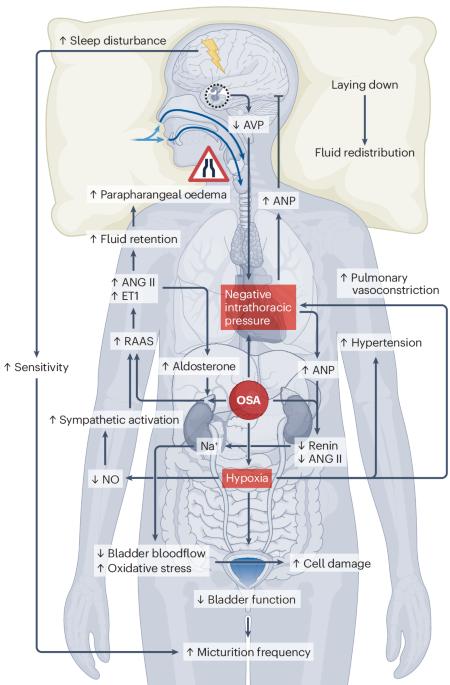 Nocturia and obstructive sleep apnoea