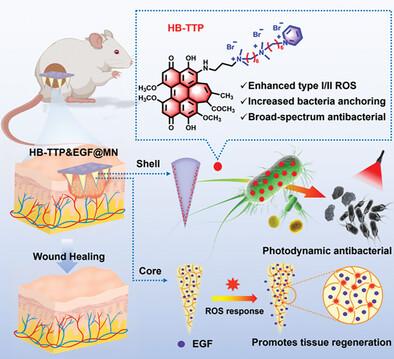 ROS-Responsive Core-Shell Microneedles Based on Simultaneous Efficient Type I/II Photosensitizers for Photodynamic Against Bacterial Biofilm Infections