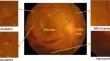 Medtransnet: advanced gating transformer network for medical image classification