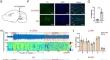 Activation of Ventral Tegmental Area Dopaminergic Neurons Projecting to the Parabrachial Nucleus Promotes Emergence from Propofol Anesthesia in Male Rats.