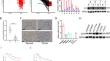 KLF4 Induces Colorectal Cancer by Promoting EMT via STAT3 Activation.