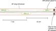 Aortic roadmapping during EVAR: a combined FEM-EM tracking feasibility study.