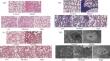 Traditional Chinese Medicine Clerodendrum japonicum (C. japonicum) Ameliorates the Pulmonary Fibrosis through Inhibiting the TGF-β/Smad3 Signaling Pathway