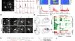 Link Brain-Wide Projectome to Neuronal Dynamics in the Mouse Brain.