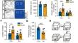 Fer-1 Protects against Isoflurane-Induced Ferroptosis in Astrocytes and Cognitive Impairment in Neonatal Mice.