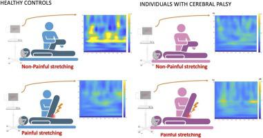 Enhanced EEG power density during painful stretching in individuals with cerebral palsy