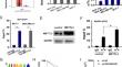 METTL3-modified lncRNA DSCAM-AS1 promotes breast cancer progression through inhibiting ferroptosis.