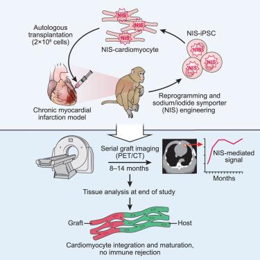 Long-term engraftment and maturation of autologous iPSC-derived cardiomyocytes in two rhesus macaques