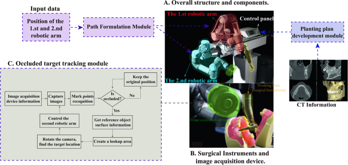 High-precision all-in-one dual robotic arm strategy in oral implant surgery.