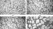 Effect of dendritic or globular (rosette-like) morphology and its parameters on hardness of Al–7.5 wt% Si castings