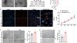 Exosomal lncRNA SNHG12 promotes angiogenesis and breast cancer progression.