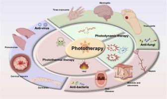 Advances in phototherapy for infectious diseases